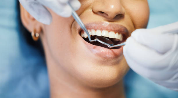 Best Emergency Denture Repair in Liberty, IN